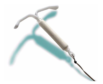 Migration of Mirena IUD - Lawsuits Against Bayer